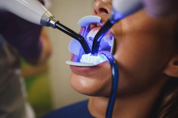 Laser Dentistry