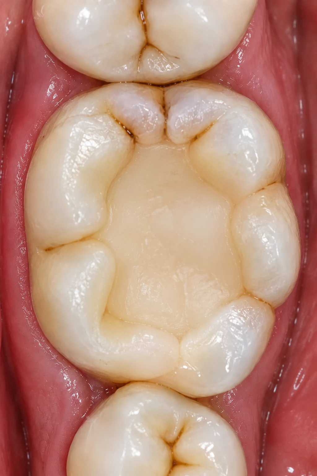 After smile treatment